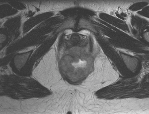  IRM de l’abdomen